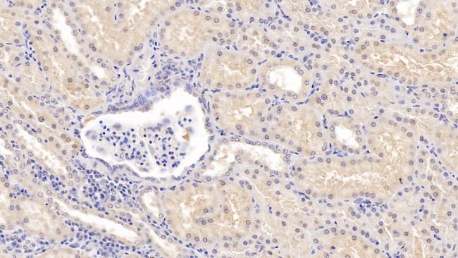 COMT Antibody in Immunohistochemistry (Paraffin) (IHC (P))