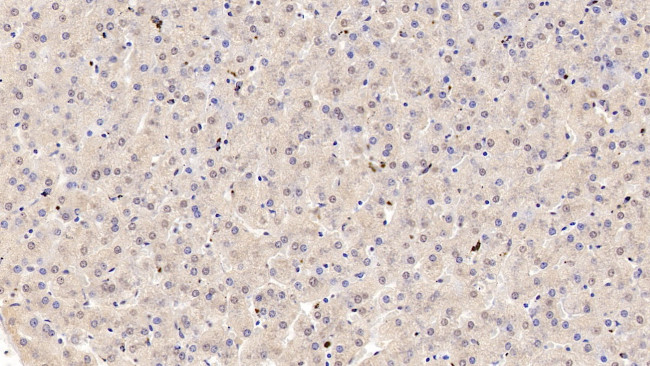 COMT Antibody in Immunohistochemistry (Paraffin) (IHC (P))