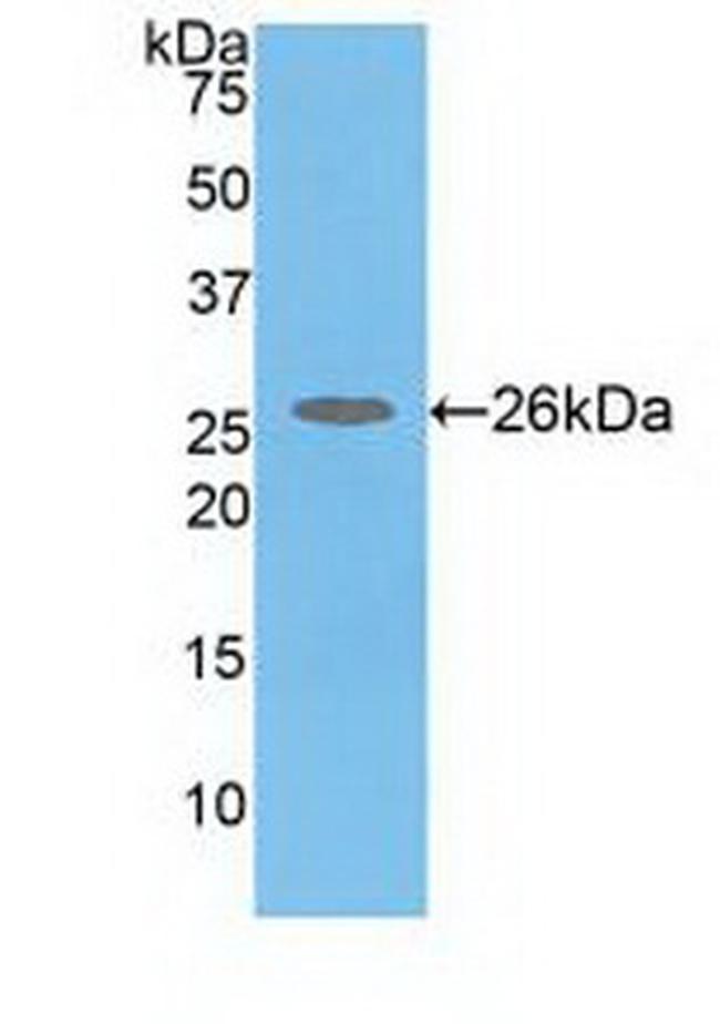 COMT Antibody in Western Blot (WB)