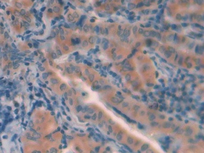 Cathepsin L Antibody in Immunohistochemistry (Paraffin) (IHC (P))