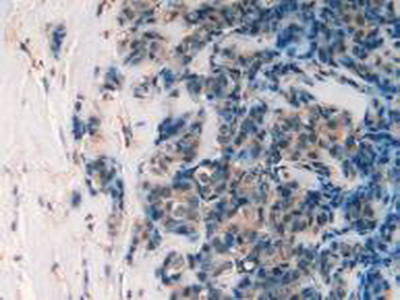 Cathepsin L Antibody in Immunohistochemistry (Paraffin) (IHC (P))