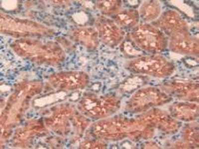 Cathepsin L Antibody in Immunohistochemistry (Paraffin) (IHC (P))