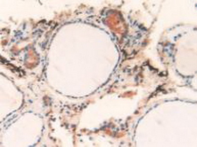 Cathepsin L Antibody in Immunohistochemistry (Paraffin) (IHC (P))