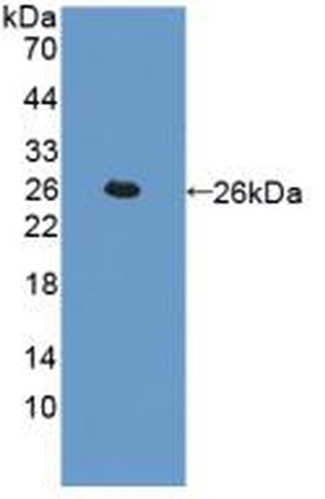 Cathepsin L Antibody in Western Blot (WB)