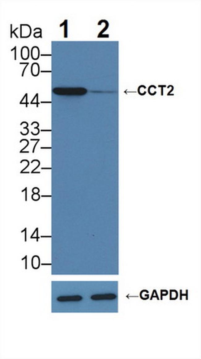 TCP-1 beta Antibody in Western Blot (WB)