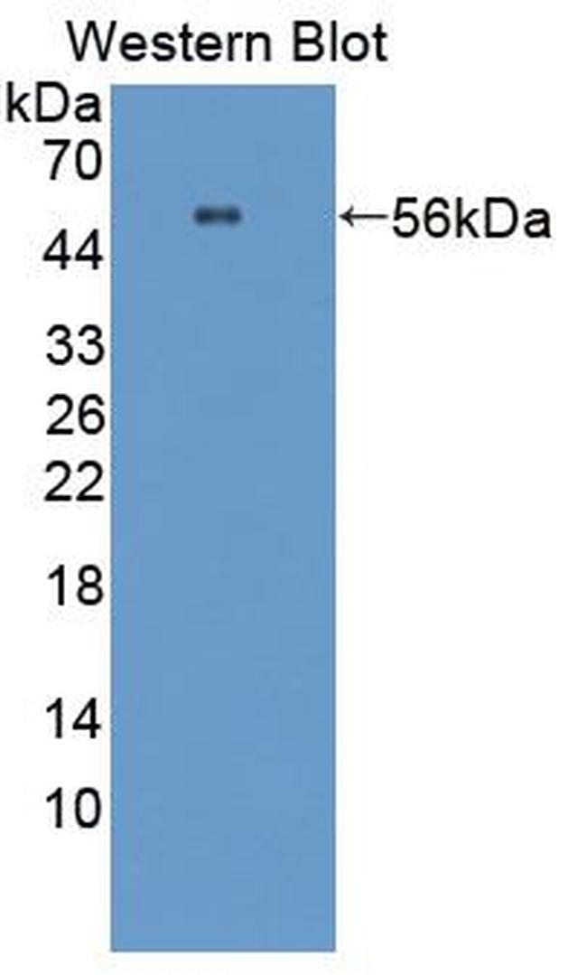 TCP-1 beta Antibody in Western Blot (WB)