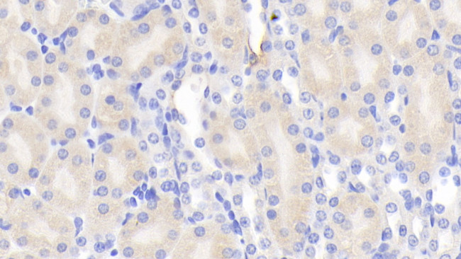 Chemerin Antibody in Immunohistochemistry (Paraffin) (IHC (P))