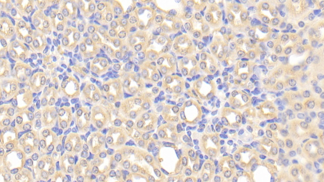 CHRDL1 Antibody in Immunohistochemistry (Paraffin) (IHC (P))