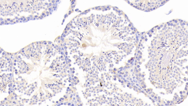 CHRDL1 Antibody in Immunohistochemistry (Paraffin) (IHC (P))