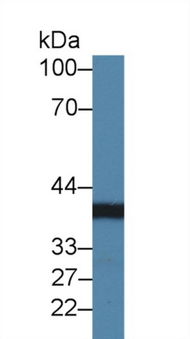 CHRDL1 Antibody in Western Blot (WB)