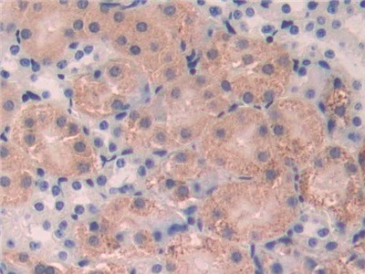 CD15 Antibody in Immunohistochemistry (Paraffin) (IHC (P))