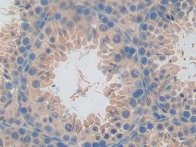 CD301 Antibody in Immunohistochemistry (Paraffin) (IHC (P))