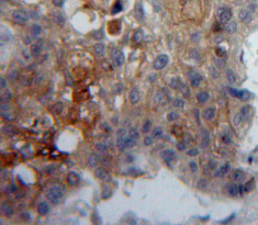 CD42d Antibody in Immunohistochemistry (Paraffin) (IHC (P))