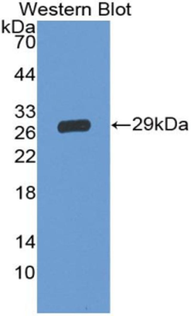 CD42d Antibody in Western Blot (WB)