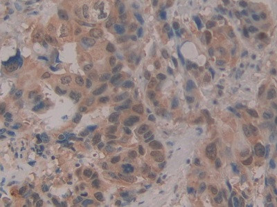 CIRBP Antibody in Immunohistochemistry (Paraffin) (IHC (P))