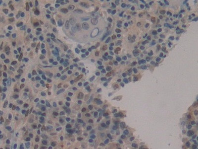 CIRBP Antibody in Immunohistochemistry (Paraffin) (IHC (P))