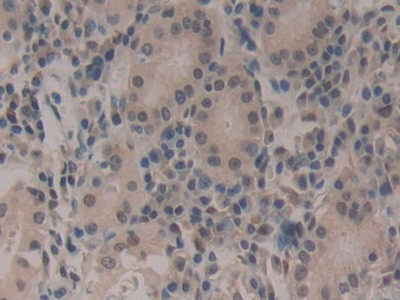 CIRBP Antibody in Immunohistochemistry (Paraffin) (IHC (P))