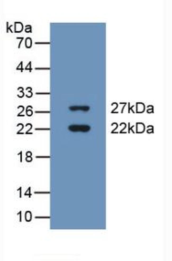 CIRBP Antibody in Western Blot (WB)