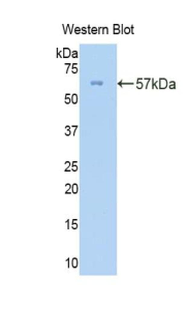 Collagen III Antibody in Western Blot (WB)