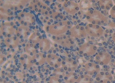 Complement C4 Antibody in Immunohistochemistry (Paraffin) (IHC (P))