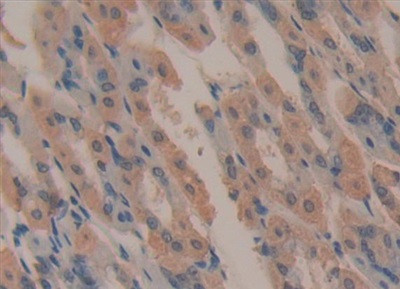 Complement C4 Antibody in Immunohistochemistry (Paraffin) (IHC (P))