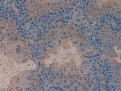 Complement C4 Antibody in Immunohistochemistry (Paraffin) (IHC (P))