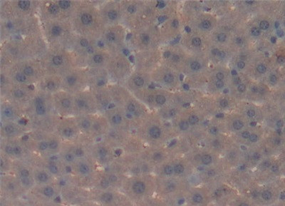 Complement C4 Antibody in Immunohistochemistry (Paraffin) (IHC (P))