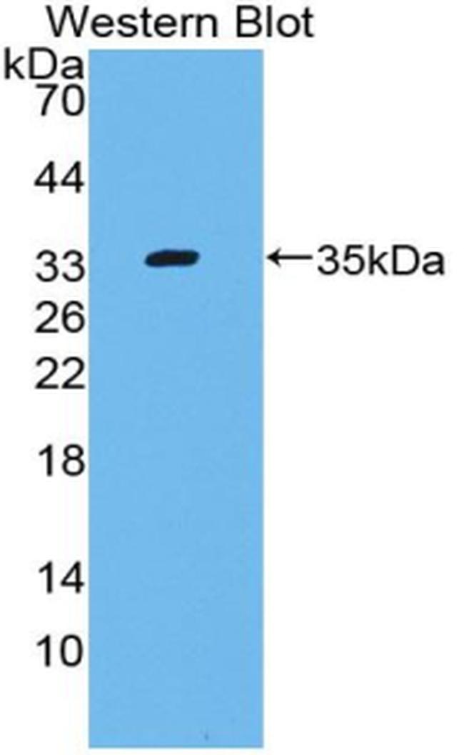 Complement C4 Antibody in Western Blot (WB)