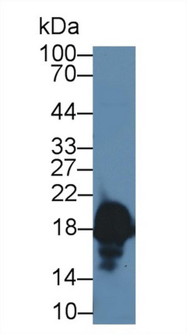 CPLX1 Antibody in Western Blot (WB)