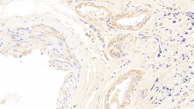 CDK4 Antibody in Immunohistochemistry (Paraffin) (IHC (P))