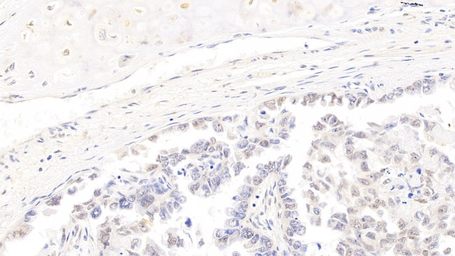 CDK4 Antibody in Immunohistochemistry (Paraffin) (IHC (P))