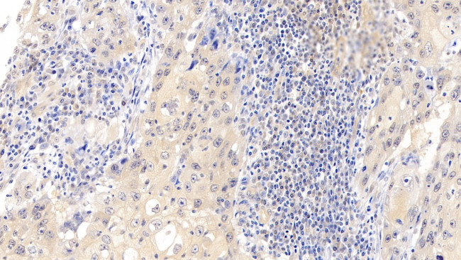 CDK4 Antibody in Immunohistochemistry (Paraffin) (IHC (P))