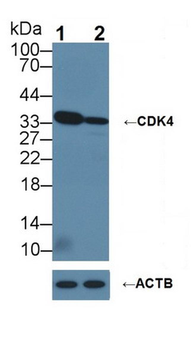 CDK4 Antibody in Western Blot (WB)