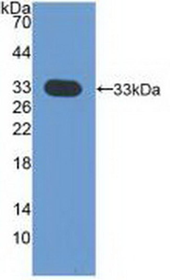 CDK4 Antibody in Western Blot (WB)