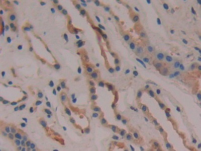 COX2 Antibody in Immunohistochemistry (Paraffin) (IHC (P))