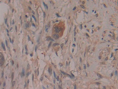 COX2 Antibody in Immunohistochemistry (Paraffin) (IHC (P))