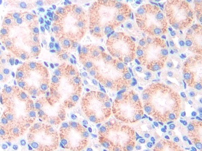 CYP21A2 Antibody in Immunohistochemistry (Paraffin) (IHC (P))