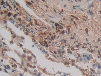 Cytohesin 1 Antibody in Immunohistochemistry (Paraffin) (IHC (P))