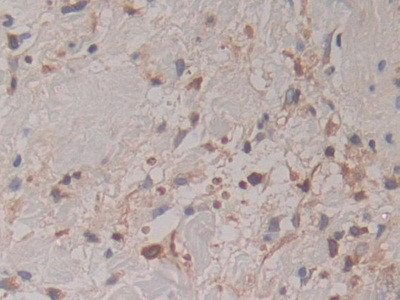 Cytohesin 1 Antibody in Immunohistochemistry (Paraffin) (IHC (P))