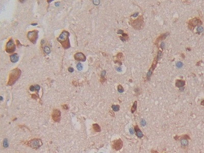 Cytohesin 1 Antibody in Immunohistochemistry (Paraffin) (IHC (P))