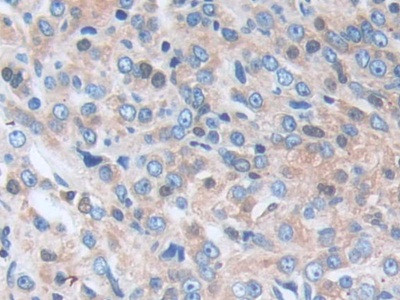 SERPINB9 Antibody in Immunohistochemistry (Paraffin) (IHC (P))