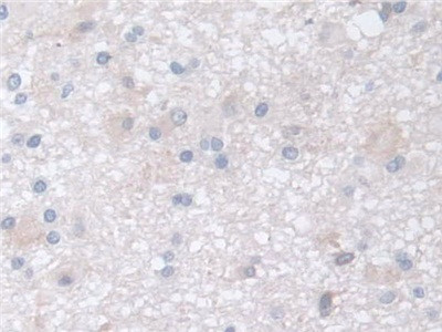 DATF1 Antibody in Immunohistochemistry (Paraffin) (IHC (P))