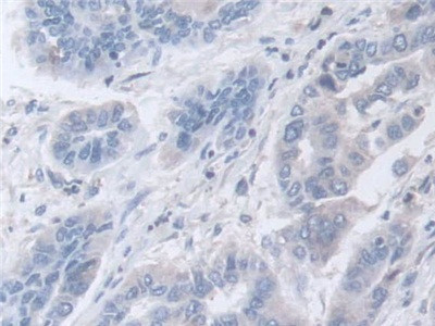 DATF1 Antibody in Immunohistochemistry (Paraffin) (IHC (P))