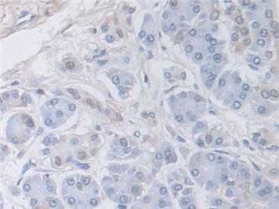 DATF1 Antibody in Immunohistochemistry (Paraffin) (IHC (P))