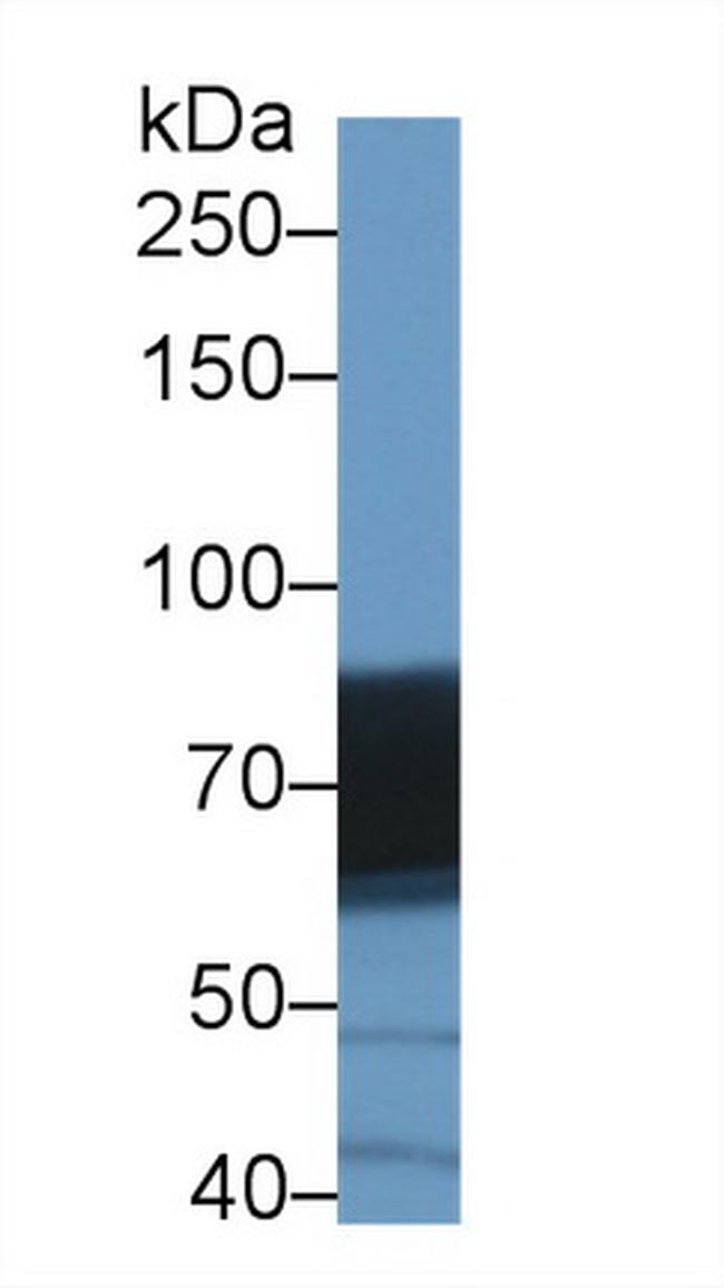 DATF1 Antibody in Western Blot (WB)