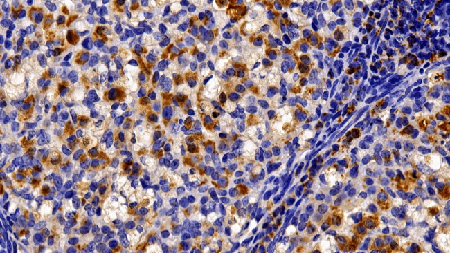 TRAIL-R2 (DR5) Antibody in Immunohistochemistry (Paraffin) (IHC (P))