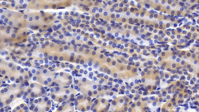 TRAIL-R2 (DR5) Antibody in Immunohistochemistry (Paraffin) (IHC (P))