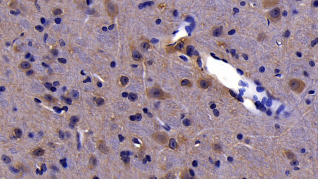 TRAIL-R2 (DR5) Antibody in Immunohistochemistry (Paraffin) (IHC (P))