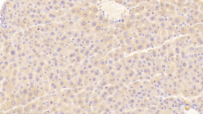 TRAIL-R2 (DR5) Antibody in Immunohistochemistry (Paraffin) (IHC (P))