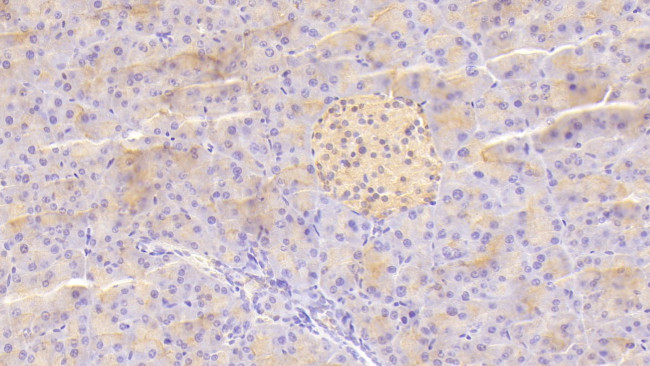 TRAIL-R2 (DR5) Antibody in Immunohistochemistry (Paraffin) (IHC (P))